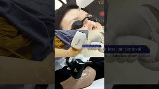 3 tips for using this diode laser hair removal machine [upl. by Lashondra714]