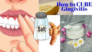 How to CURE Gingivitis With Turmeric Coconut Oil Baking Soda or LEMONS No dentist required [upl. by Enorej]