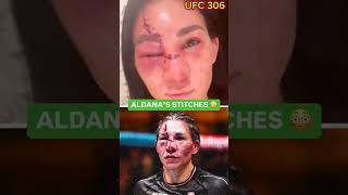 AFTER UFC 306 FIGHT IRENE ALDANA 😭😭 [upl. by Cindi]