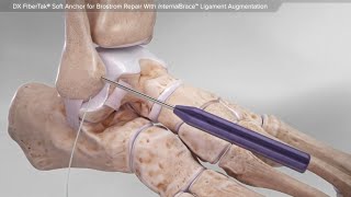 ligamentos do tornozelo [upl. by Rochette360]