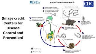 Rat lungworm that can invade the human brain found in Georgia rodents [upl. by Rednijar420]