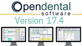 Open Dental Version 174  Highlights and Features [upl. by Itsyrc]