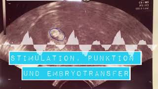 4ICSI  Stimulation Punktion und Embryotransfer was diesmal anders lief [upl. by Selij]