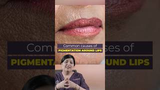 होंठो के आस पास के कालेपन को कैसे दूर करे  Pigmentation around mouth  Best dermatologist in Delhi [upl. by Garrard]