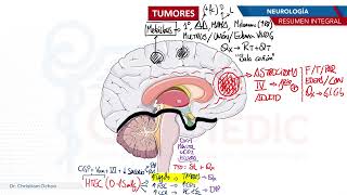 Neurología  Tumores [upl. by Eicart]