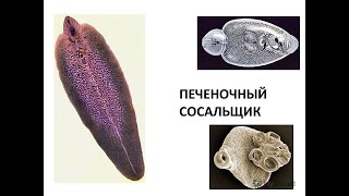 Печеночный сосальщик Fasciola hepatica [upl. by Nauqram]