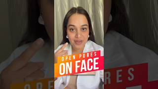 Open Pores on Face  Open Pores Home Remedy  Open Pores Treatment [upl. by Ardnasil]