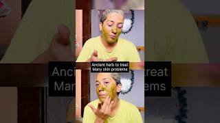 Ayurveda Face Mask for all types of Acne Pimple  Home remedies for Acne shorts [upl. by Romanas]