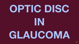 Glaucoma Session 06 Clinical Evaluation of a Glaucoma Patient Part 3 Fundus Examination [upl. by Eduardo]