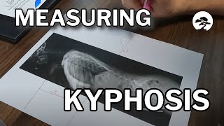 How to Hand Measure Kyphosis Lordosis and Pelvic Incidence on Xrays [upl. by Eatnuahs761]