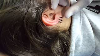 Como se hace el Conch Piercing [upl. by Aneis]