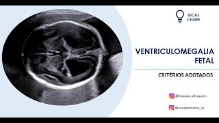 Ventriculomegalia fetal como avaliar [upl. by Nireves240]