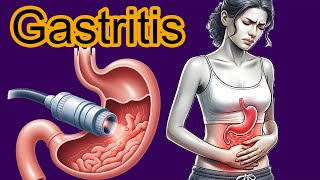 5 Early signs of Gastritis Gastritis diagnosis and treatment [upl. by Zeitler]