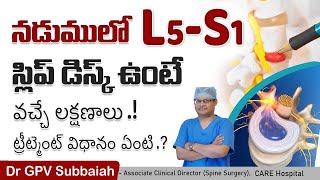 L5S1 disc prolapse symptoms diagnosis amp treatment  Health video  Dr GPV Subbaiah [upl. by Va741]