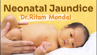 Newborn Jaundice  what to do by DrRitam Mondal MD [upl. by Paviour533]