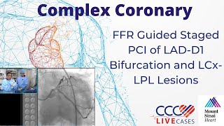 FFR guided staged PCI of LADD1 Bifurcation  CCC Live Cases Sept 2017 [upl. by Lledner908]