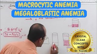 Macrocytic Anemia  Megaloblastic Anemia 🩺 [upl. by Huskamp]