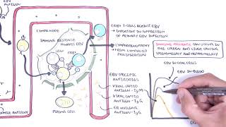 Epstein Barr Virus and Infectious Mononucleosis pathophysiology investigations and treatment [upl. by Rainie]