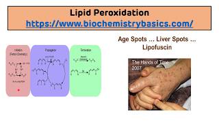 Lipid Peroxidation  Measurement of Free Radical Burden [upl. by Haliehs]