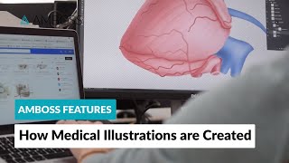 AMBOSS Features How Medical Illustrations are Created [upl. by Kcireddor829]