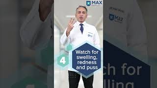 5 tips to treat Skin Ulcers at home  Max Hospital [upl. by Now]