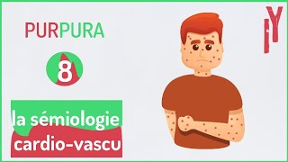 EPISODE7 sémiologie cardiovasculaire purpura [upl. by Noyek]