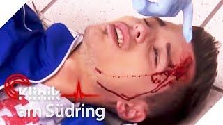 Bruder hat Gehirntumor Zufällige Schockdiagnose  FreddyFreitag  Klinik am Südring  SAT1 TV [upl. by Atilahs]