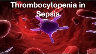 Thrombocytopenia in Sepsis [upl. by Eciram]