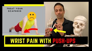 Cant do pushups WRIST PAIN Treat the Scaphoid [upl. by Phillie]