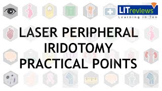 Laser Peripheral Iridotomy Practical Point [upl. by Llenrac]