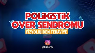 Polikistik Over Sendromu PKOS  Fizyolojiden Tedaviye [upl. by Anirtep]