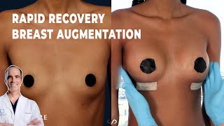 RAPID RECOVERY BREAST AUGMENTATION  24 Hour Result  Dr David Stoker [upl. by Yerroc15]