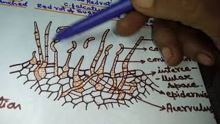 Colletotrichum in Hindi Red rot of sugarcane [upl. by Lyreb]