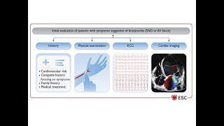 ESC Guidelines Clinical Assessment for Cardiac Pacing [upl. by Bremen77]