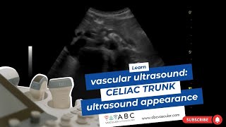 Celiac Trunk ultrasound appearance vascular ultrasound learning [upl. by Kcirdahc]