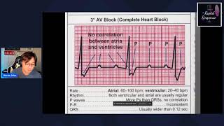 Part 2 Electrocardiography [upl. by Nyladam436]