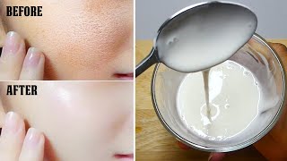 Add Just 1 Thing With Rice flour Cream And Get Full Fairness  Instant Skin Whitening Face Pack [upl. by Kulseth]