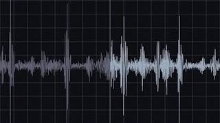 Pericardial Friction Rub Recording amp Waveform  Eko Health [upl. by Sivam]