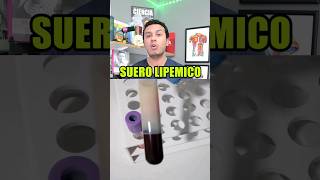 suero lipemico [upl. by Tahmosh]