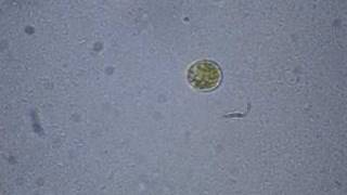 Dinoflagellate Swims the Salt Pond [upl. by Volin602]