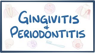 Gingivitis and periodontitis  causes symptoms diagnosis treatment pathology [upl. by Stock889]