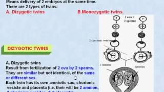 44 General Embryology Twins amp Dizygotic Twins [upl. by Suryc]