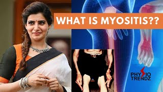 Myositis amp Types How to Treat it With Physiotherapy [upl. by Aizti]