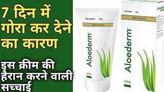 Gora Hone Ki Best Cream Aloederm Skin Cream  Aloederm Skin Cream Use In Hindi  Aloederm Skin Cream [upl. by Arinaid117]