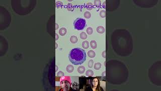 Prolymphocyte Morphological Characteristics [upl. by Amluz]