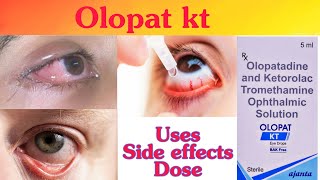 olopat kt eye drops in hindi  olopat kt drop  olopat kt eye drop uses in hindi [upl. by Bucher]