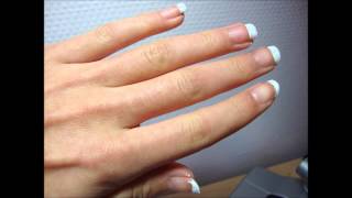 Witte nagels [upl. by Natalie]