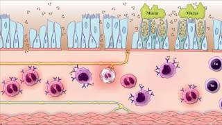 Asthma Pathogenesis Animation Part 2reexposure to allergen Robbins pathology [upl. by Godber]