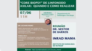 quotCORE BIOPSYquot de Linfonodo Axilar Quando e Como Realizar [upl. by Dannica]