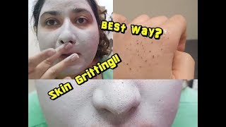 How To Remove Blackheads and Minimize Pores w Korean Skincare [upl. by Violette]